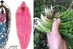 خطر ابتلا به بیماری انگلی فاسیولا در گیلان